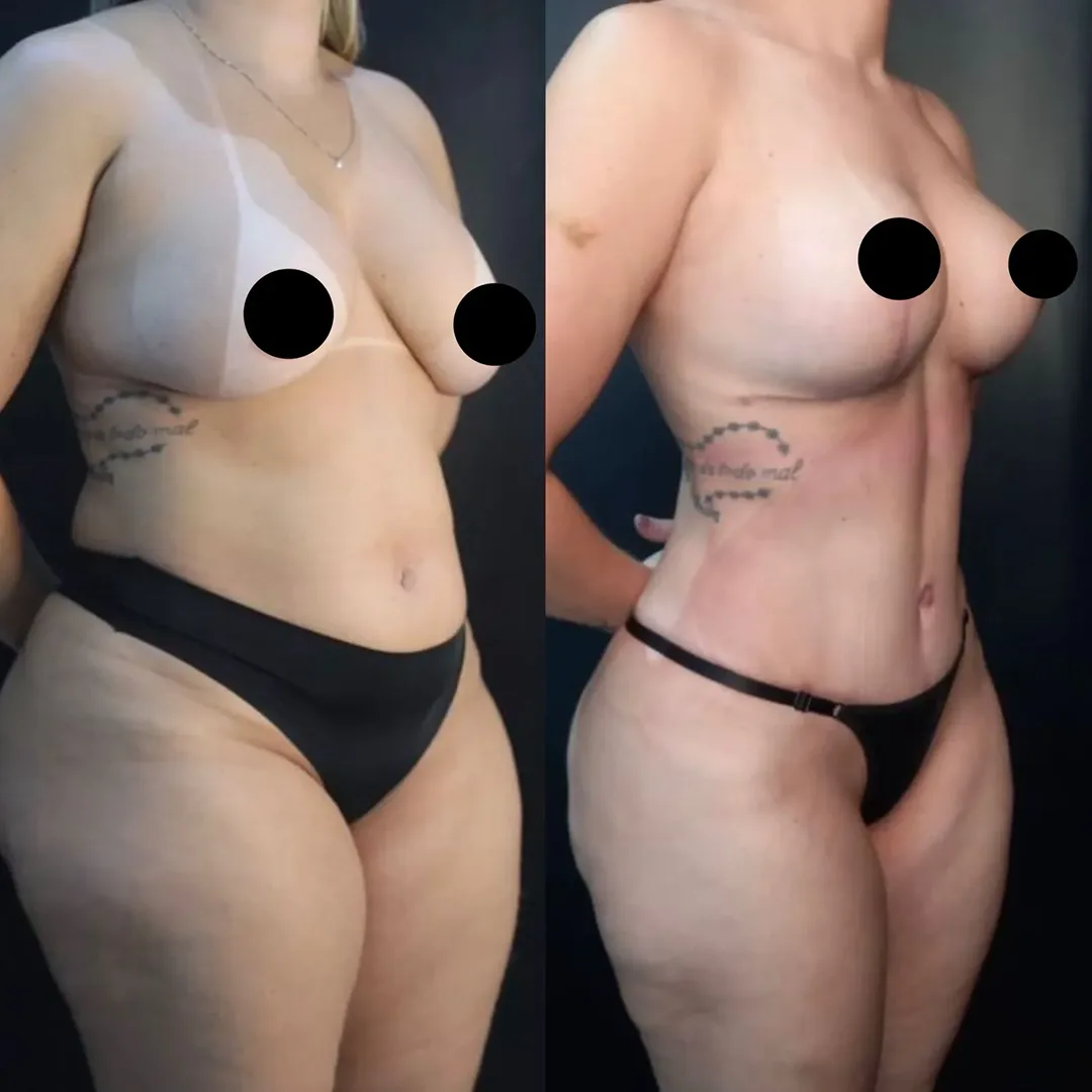 Antes e depois — resultado real