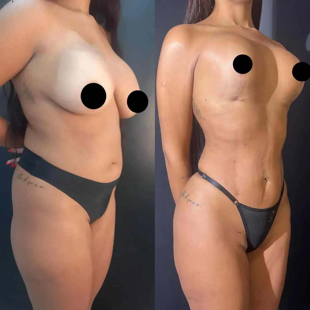 Antes e depois — resultado real