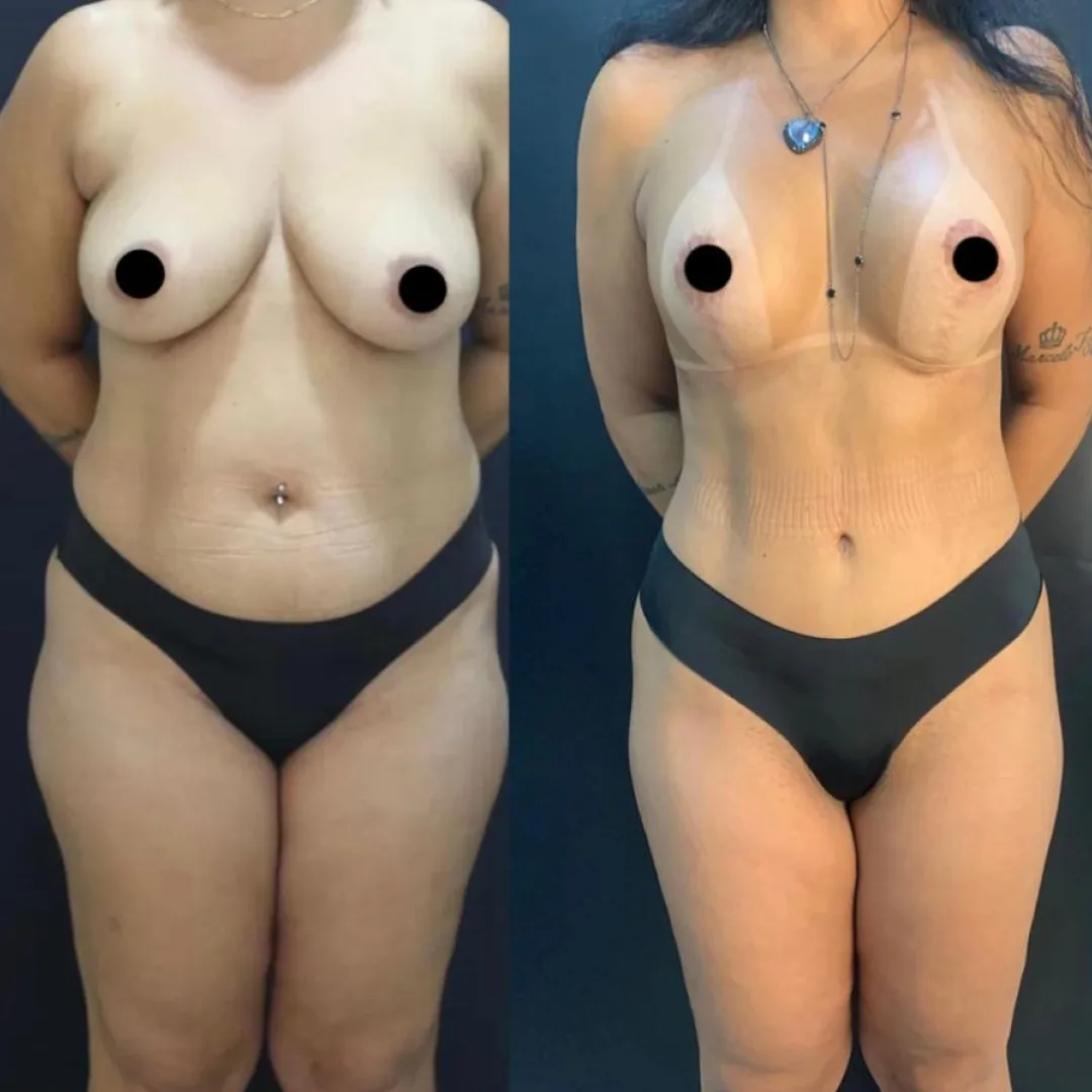 Antes e depois — resultado real